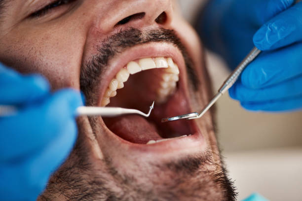 Best Emergency Broken Tooth Repair in Clendenin, WV